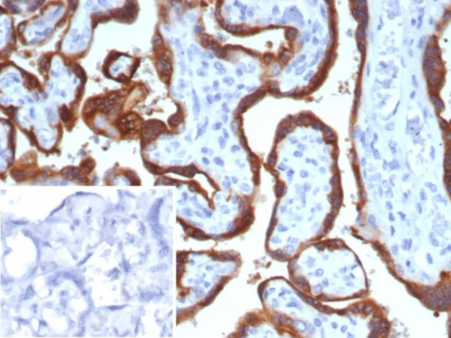 HCG-beta (Pregnancy and Choriocarcinoma Marker) Antibody in Immunohistochemistry (Paraffin) (IHC (P))