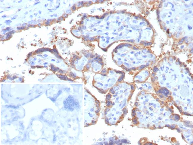 HCG-beta (Pregnancy and Choriocarcinoma Marker) Antibody in Immunohistochemistry (Paraffin) (IHC (P))