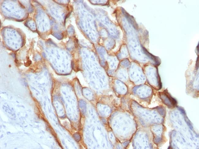 HCG-beta Antibody in Immunohistochemistry (Paraffin) (IHC (P))