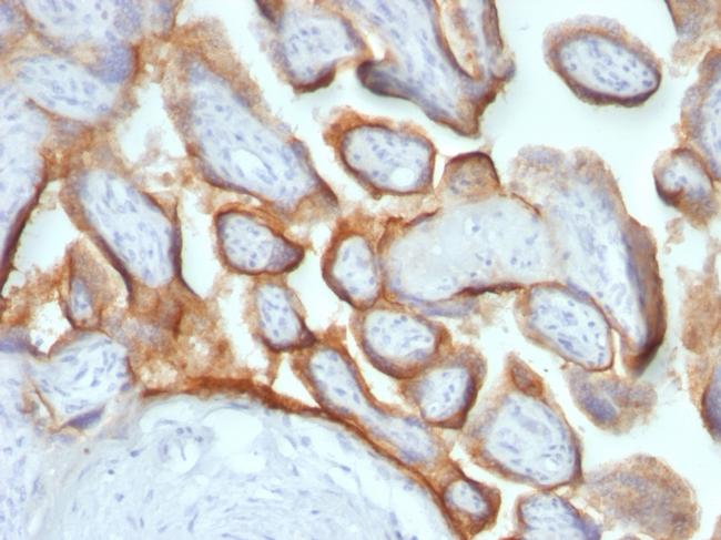 HCG-beta Antibody in Immunohistochemistry (Paraffin) (IHC (P))