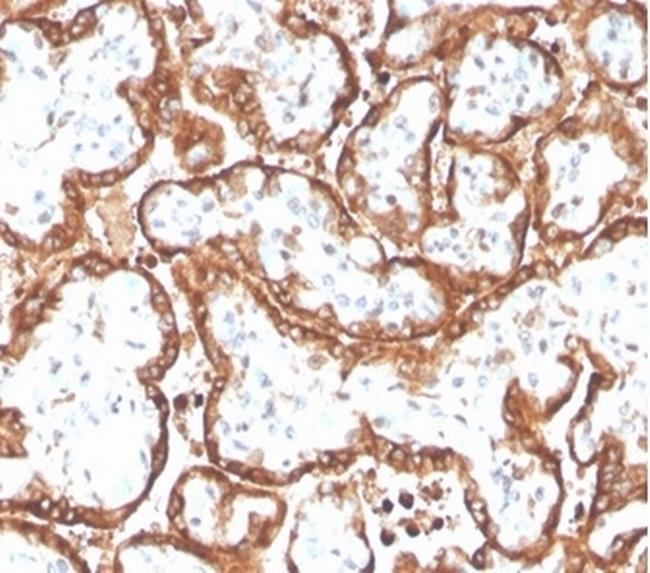 HCG-beta (Pregnancy and Choriocarcinoma Marker) Antibody in Immunohistochemistry (Paraffin) (IHC (P))