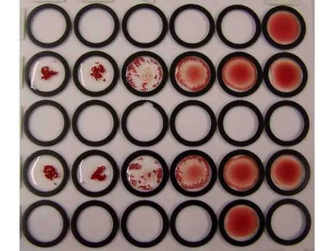 Red Blood Cell Antibody in Agglutination (AGG)