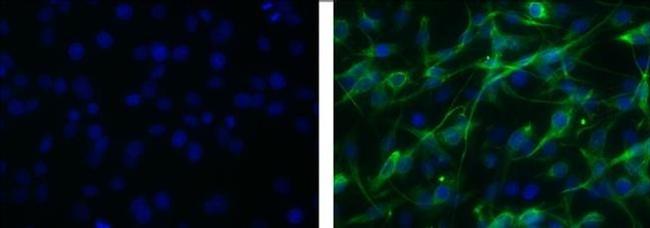 Vimentin Antibody in Immunocytochemistry (ICC/IF)