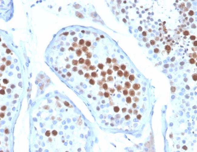 KIF2C (Kinesin Family Member 2C)/MCAK Antibody in Immunohistochemistry (Paraffin) (IHC (P))