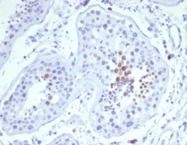 KIF2C (Kinesin Family Member 2C)/MCAK Antibody in Immunohistochemistry (Paraffin) (IHC (P))