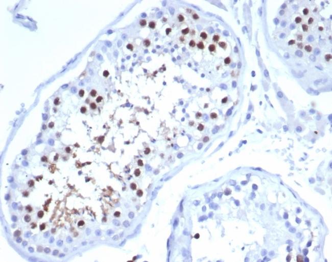 KIF2C (Kinesin Family Member 2C)/MCAK Antibody in Immunohistochemistry (Paraffin) (IHC (P))