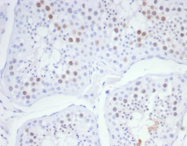 KIF2C (Kinesin Family Member 2C)/MCAK Antibody in Immunohistochemistry (Paraffin) (IHC (P))