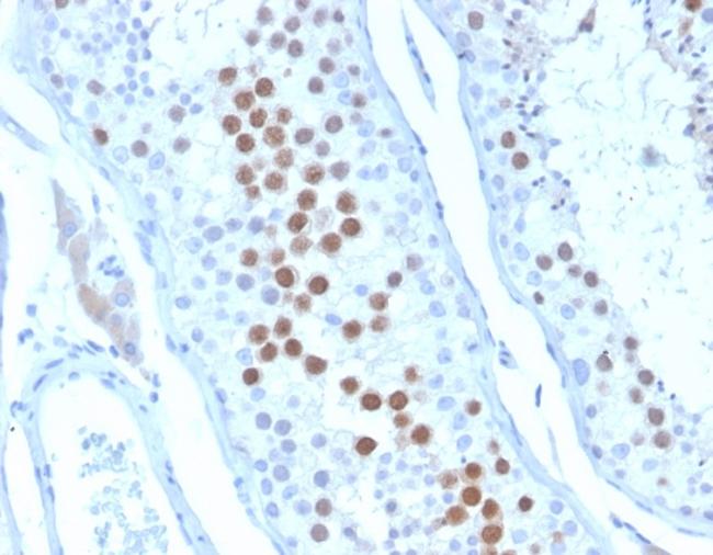 KIF2C (Kinesin Family Member 2C)/MCAK Antibody in Immunohistochemistry (Paraffin) (IHC (P))