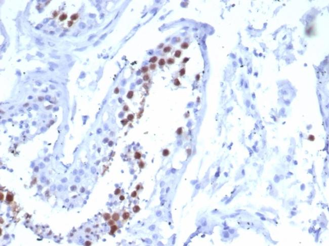 KIF2C (Kinesin Family Member 2C)/MCAK Antibody in Immunohistochemistry (Paraffin) (IHC (P))