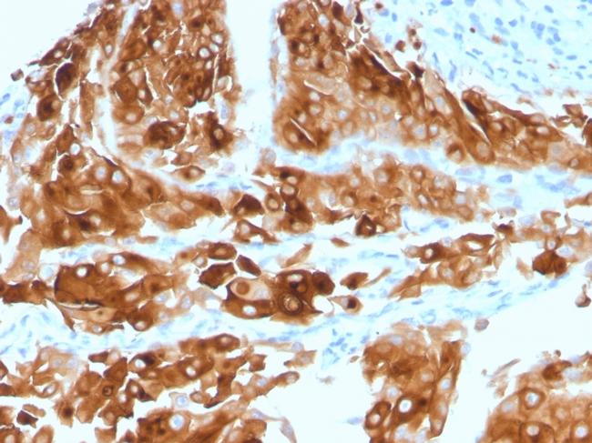 Uroplakin 1A Antibody in Immunohistochemistry (Paraffin) (IHC (P))