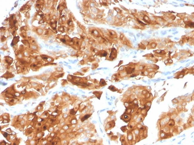 Uroplakin 1A Antibody in Immunohistochemistry (Paraffin) (IHC (P))