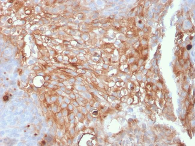 Uroplakin 1A Antibody in Immunohistochemistry (Paraffin) (IHC (P))