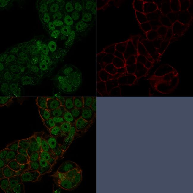 CHD4 Antibody in Immunocytochemistry (ICC/IF)