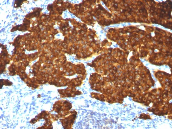 Chromogranin A/CHGA (Neuroendocrine Marker) Antibody in Immunohistochemistry (Paraffin) (IHC (P))