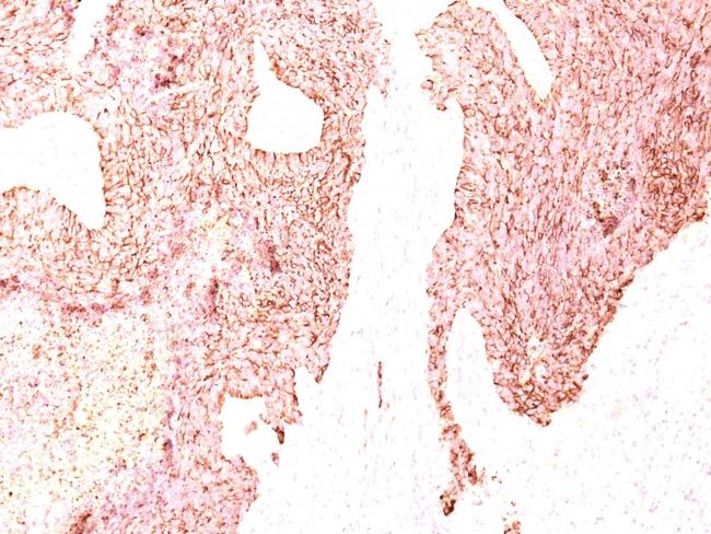 Chromogranin A/CHGA (Neuroendocrine Marker) Antibody in Immunohistochemistry (Paraffin) (IHC (P))