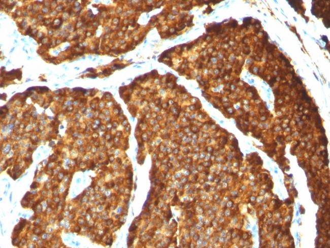 Chromogranin A/CHGA (Neuroendocrine Marker) Antibody in Immunohistochemistry (Paraffin) (IHC (P))