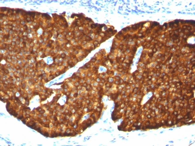 Chromogranin A/CHGA (Neuroendocrine Marker) Antibody in Immunohistochemistry (Paraffin) (IHC (P))