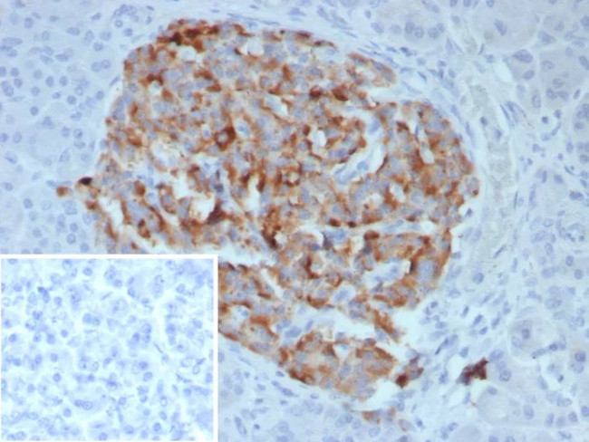 Chromogranin B/CHGB (Neuroendocrine Marker) Antibody in Immunohistochemistry (Paraffin) (IHC (P))