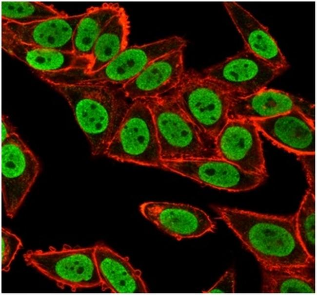 CHEK2 Antibody in Immunocytochemistry (ICC/IF)