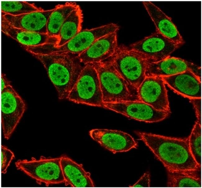 CHEK2 Antibody in Immunocytochemistry (ICC/IF)