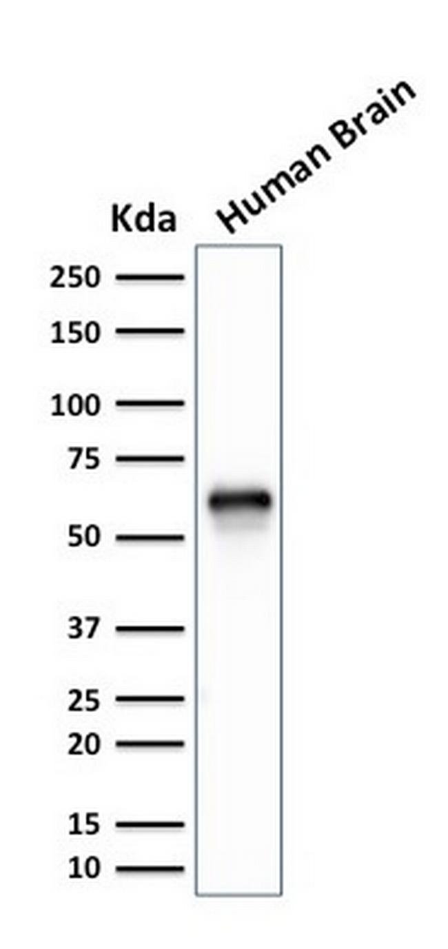 GPN1/XAB1 (DNA Repair and Protein Synthesis) Antibody in Western Blot (WB)