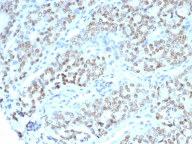 BTBD9 Antibody in Immunohistochemistry (Paraffin) (IHC (P))