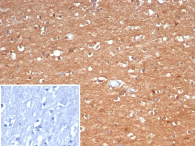 Creatine Phosphokinase-BB (CK-BB) Antibody in Immunohistochemistry (Paraffin) (IHC (P))