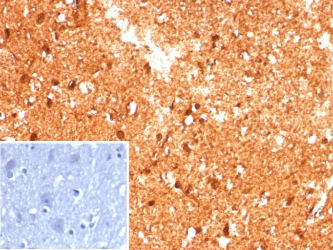 Creatine Phosphokinase-BB (CK-BB) Antibody in Immunohistochemistry (Paraffin) (IHC (P))