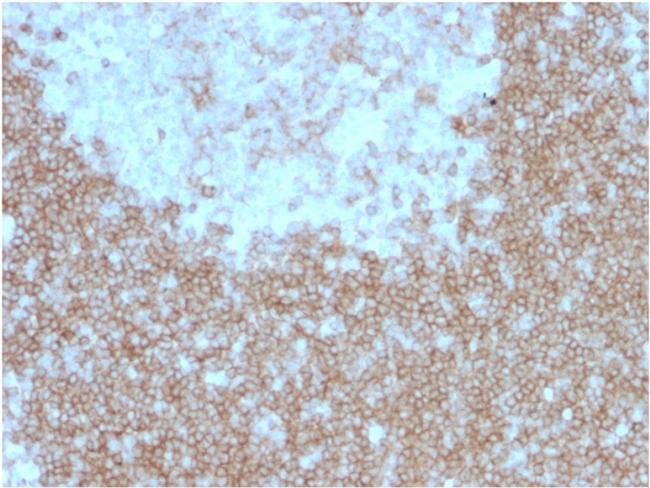 CD268/BAFFR/TNFRSF13C Antibody in Immunohistochemistry (Paraffin) (IHC (P))