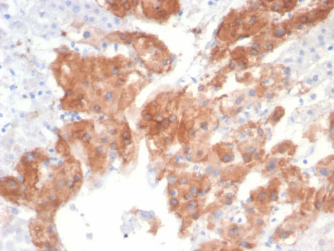 IL22RA2 Antibody in Immunohistochemistry (Paraffin) (IHC (P))