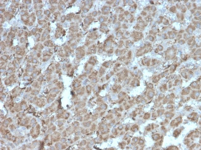 Topoisomerase I Mitochondrial (TOP1MT) Antibody in Immunohistochemistry (Paraffin) (IHC (P))