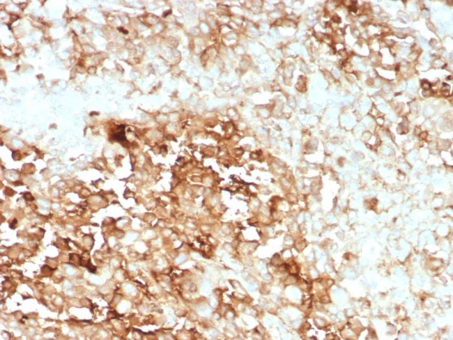 Clusterin/Apolipoprotein J (APO-J) Antibody in Immunohistochemistry (Paraffin) (IHC (P))