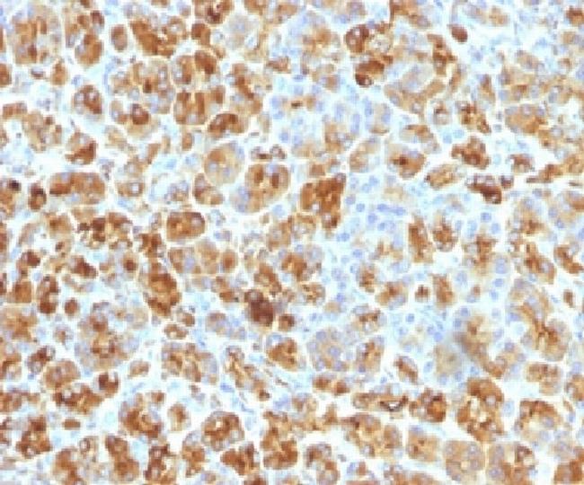 Alpha-1-Antichymotrypsin (SERPINA3) (Histiocytoma Marker) Antibody in Immunohistochemistry (Paraffin) (IHC (P))