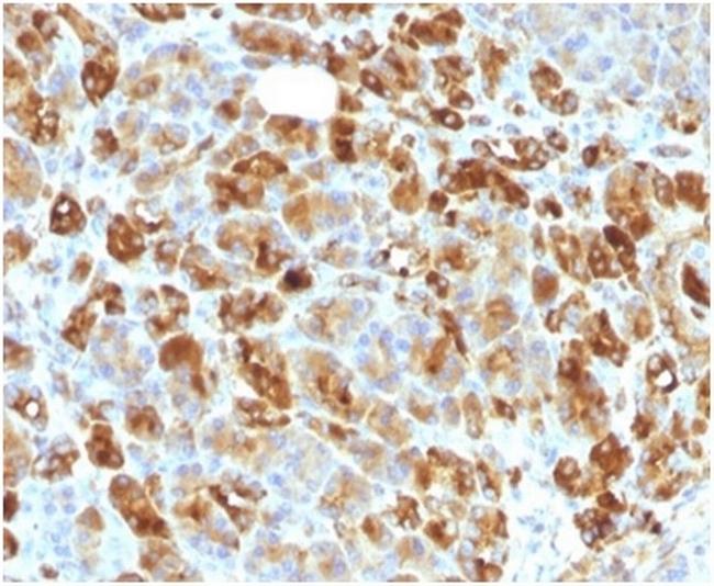 Alpha-1-Antichymotrypsin (SERPINA3) (Histiocytoma Marker) Antibody in Immunohistochemistry (Paraffin) (IHC (P))