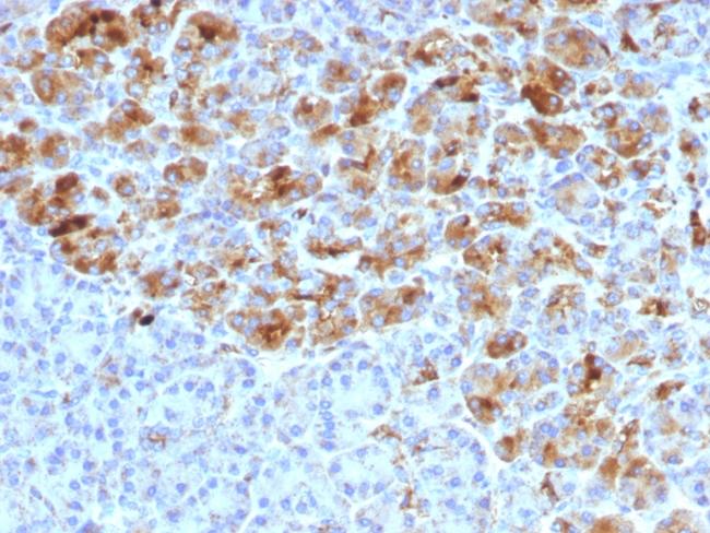 Alpha-1-Antichymotrypsin (SERPINA3) (Histiocytoma Marker) Antibody in Immunohistochemistry (Paraffin) (IHC (P))