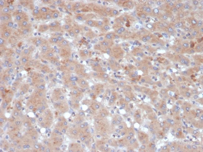 Alpha-1-Antichymotrypsin (SERPINA3) (Histiocytoma Marker) Antibody in Immunohistochemistry (Paraffin) (IHC (P))