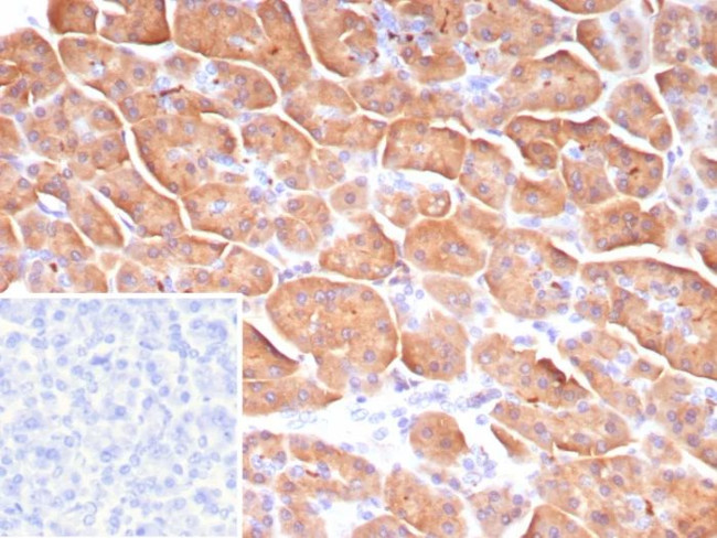 Colipase/CLPS Antibody in Immunohistochemistry (Paraffin) (IHC (P))