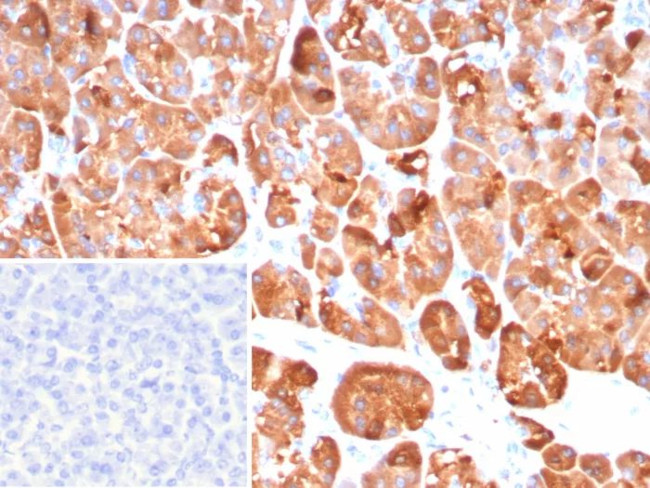 Colipase/CLPS Antibody in Immunohistochemistry (Paraffin) (IHC (P))