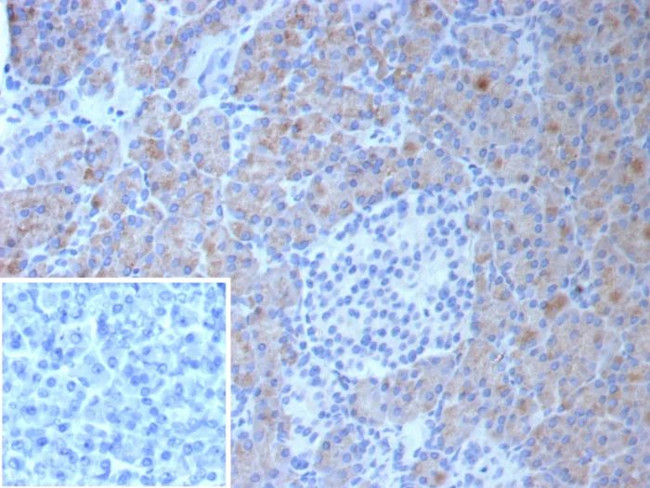 Colipase/CLPS Antibody in Immunohistochemistry (Paraffin) (IHC (P))