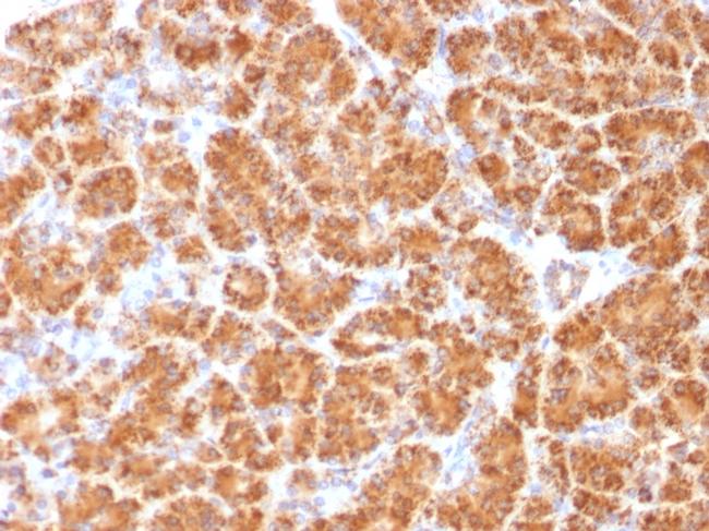 Clathrin, Light Chain Antibody in Immunohistochemistry (Paraffin) (IHC (P))