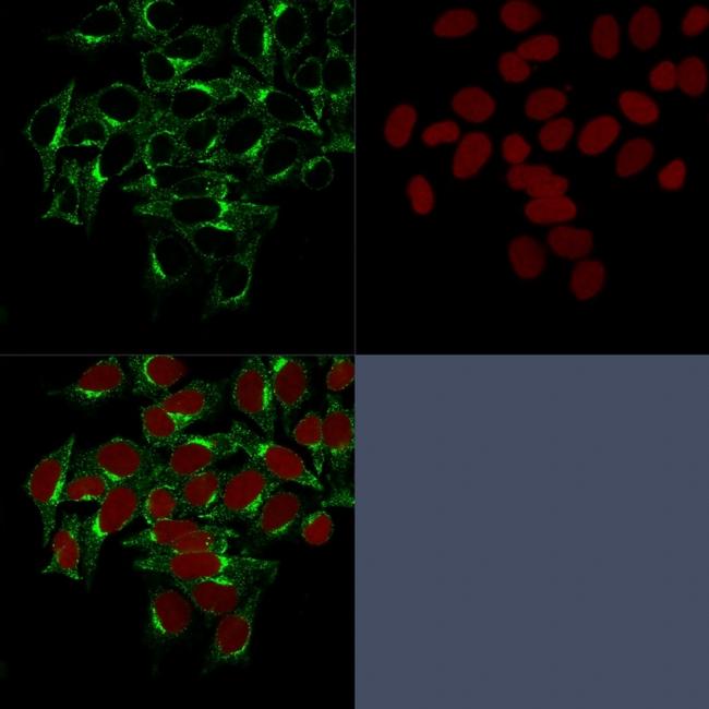 Clathrin, Heavy Chain Antibody in Immunocytochemistry (ICC/IF)