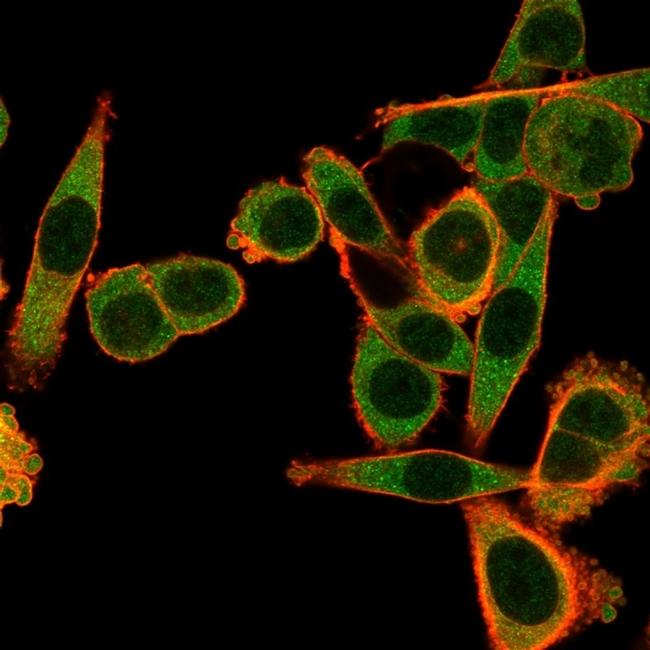 SPI-C/Transcription factor Spi-C Antibody in Immunocytochemistry (ICC/IF)