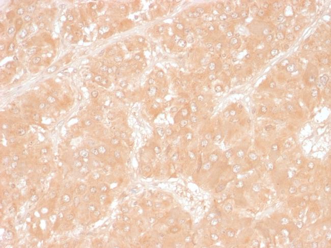 Adipophilin/Perilipin-2 Antibody in Immunohistochemistry (Paraffin) (IHC (P))