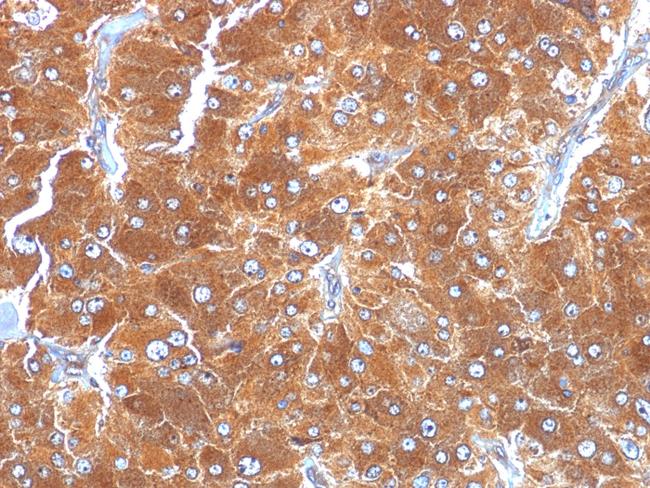 Adipophilin/Perilipin-2 (Marker of Lipid Accumulation) Antibody in Immunohistochemistry (Paraffin) (IHC (P))