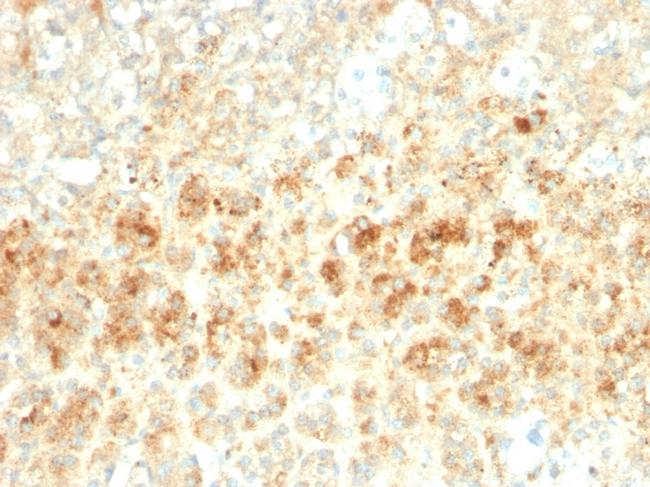 Adipophilin/Perilipin-2 Antibody in Immunohistochemistry (Paraffin) (IHC (P))