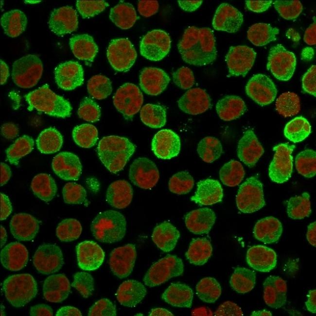 Calponin-1 (Smooth Muscle Marker) Antibody in Immunocytochemistry (ICC/IF)