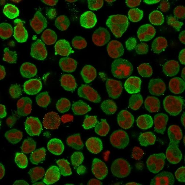 Calponin-1 (Smooth Muscle Marker) Antibody in Immunocytochemistry (ICC/IF)