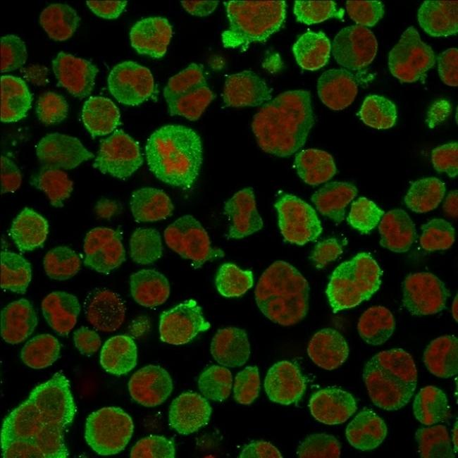 Calponin-1 (Smooth Muscle Marker) Antibody in Immunocytochemistry (ICC/IF)