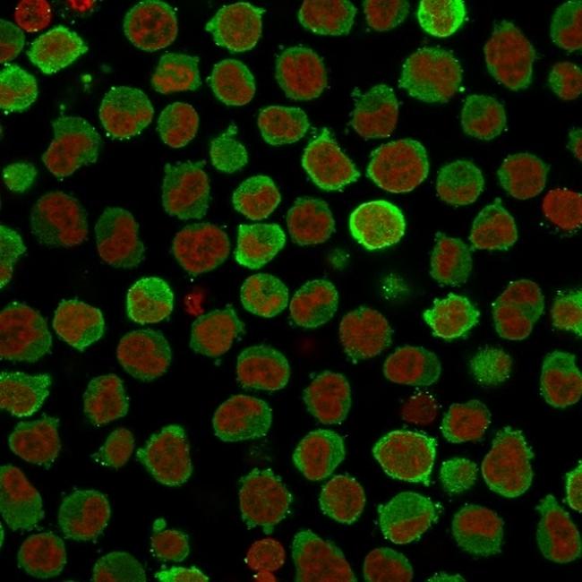 Calponin-1 (Smooth Muscle Marker) Antibody in Immunocytochemistry (ICC/IF)