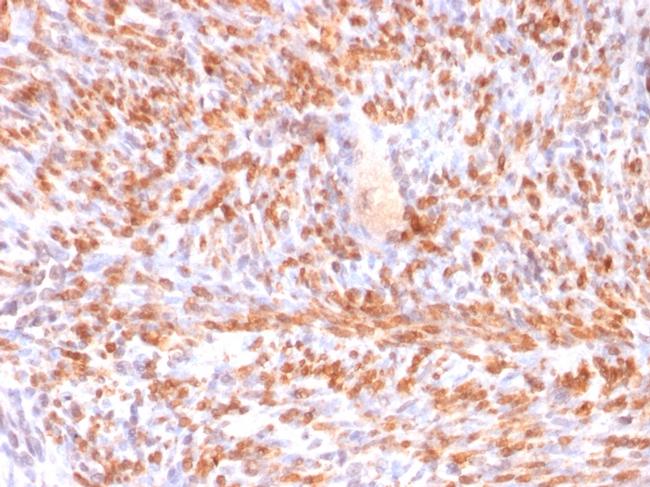 Calponin-1 Antibody in Immunohistochemistry (Paraffin) (IHC (P))